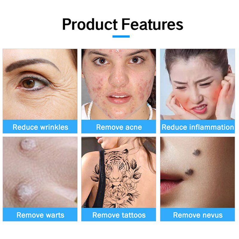Facial Beauty Plasma Pen for mole and wart removal on face Pakistan Facial Beauty Plasma Pen product features - wrinkles acne warts tattoo removal Pakistan